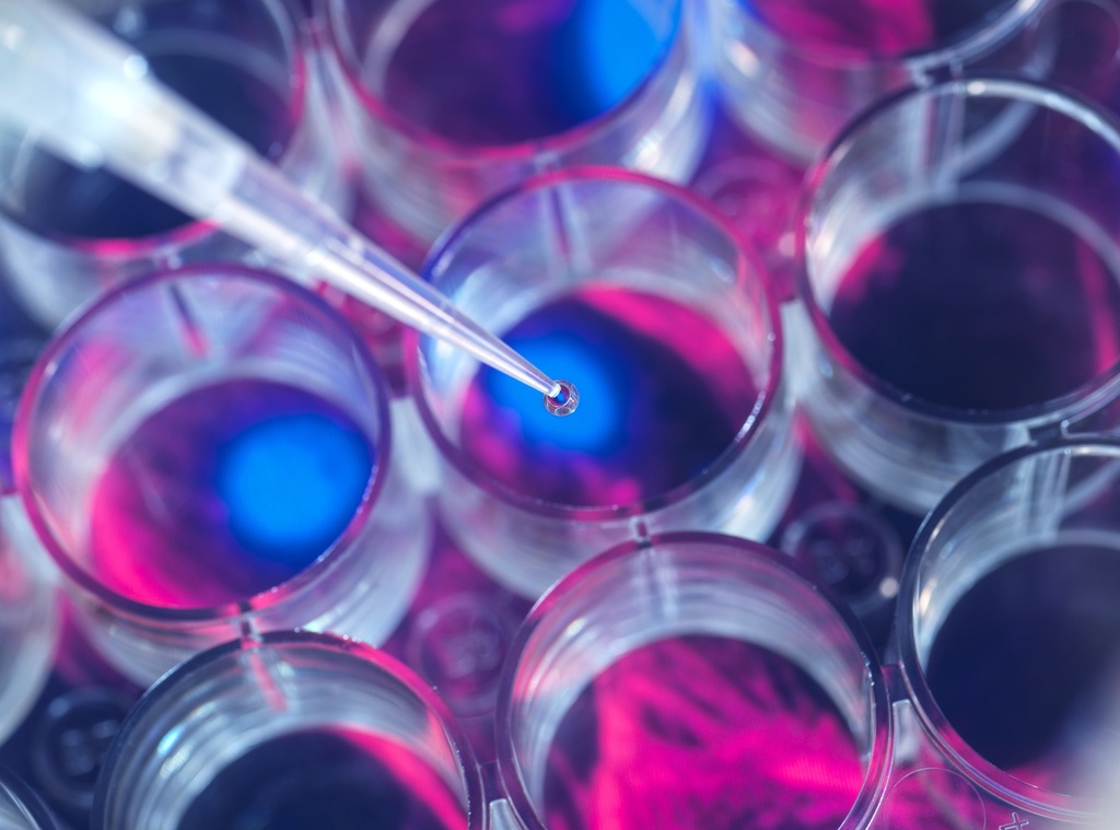 Histone H2AX (phospho-Ser139) Polyclonal