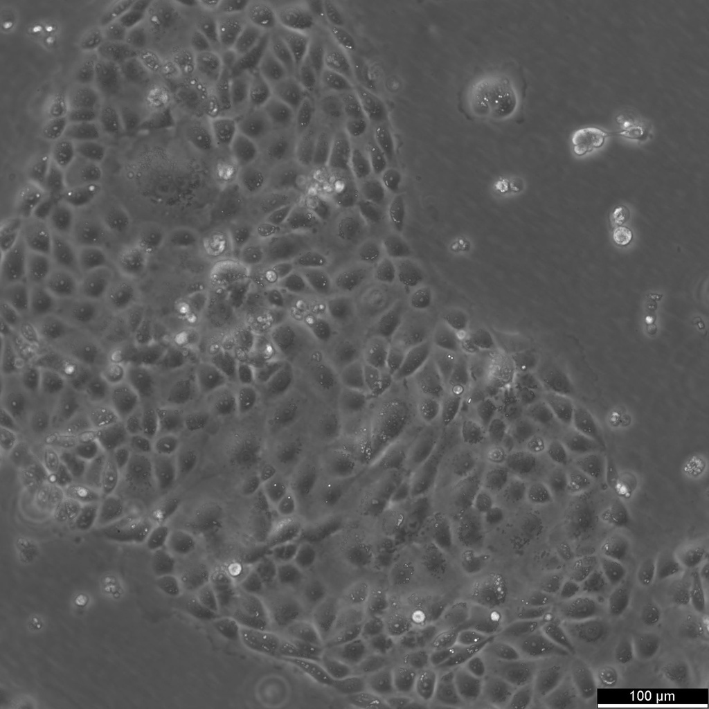 16HBE14o- Cells