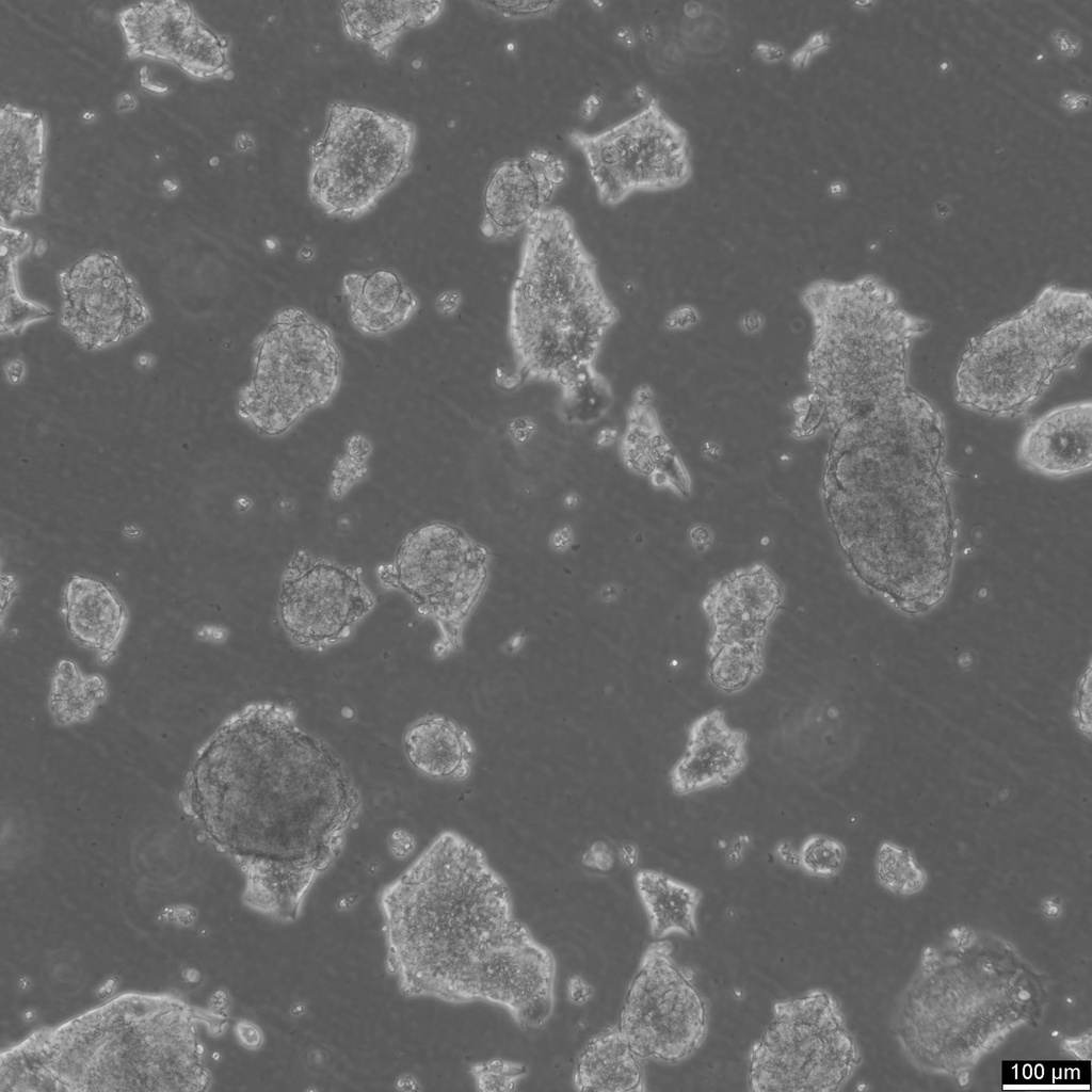 HROC147Met1 Cells